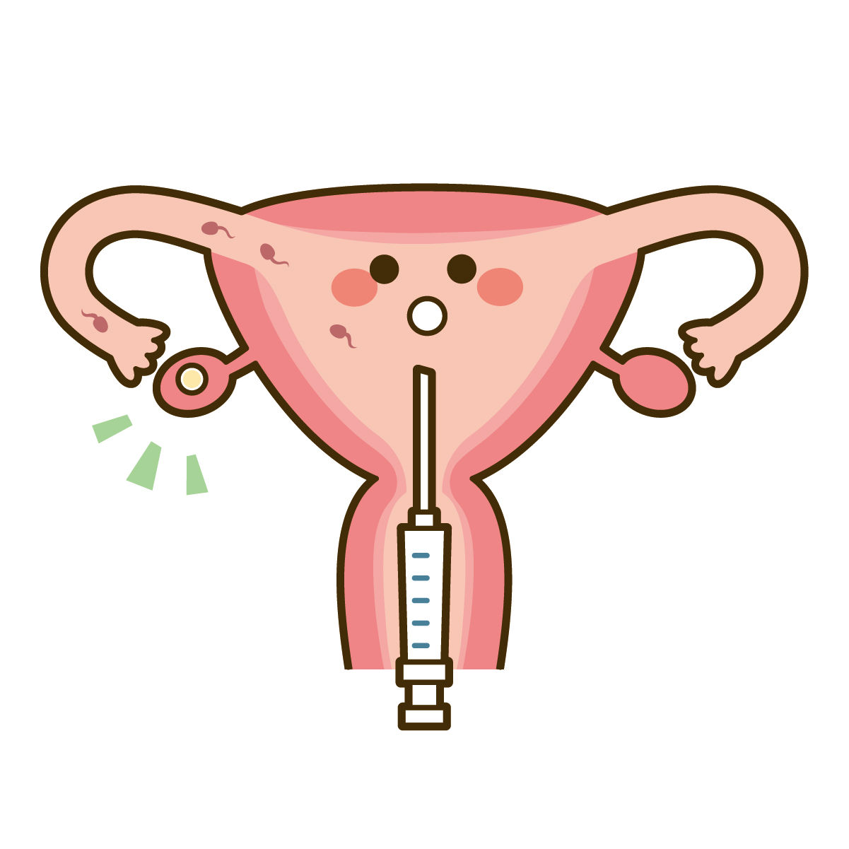 人工授精イメージ図